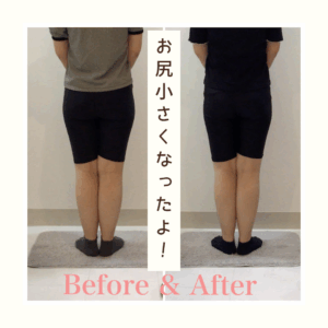 骨盤矯正、産後の骨盤矯正