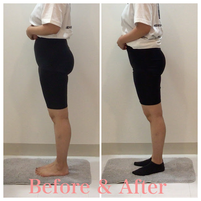 骨盤矯正、産後の骨盤矯正