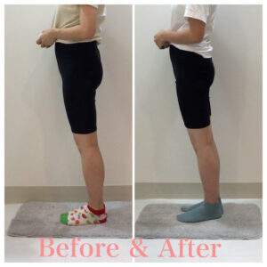 産後の骨盤矯正、骨盤矯正、産後整体