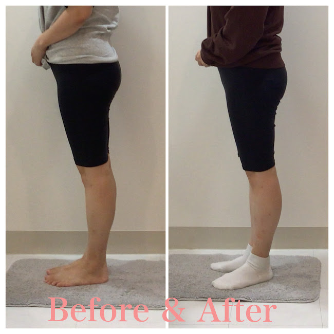 骨盤矯正、産後の骨盤矯正