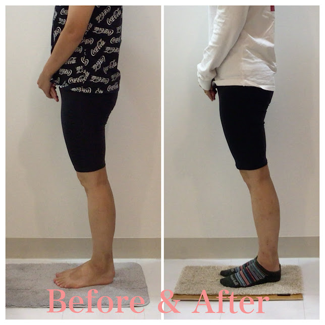 骨盤矯正、産後の骨盤矯正