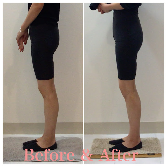 骨盤矯正、ヒップアップ