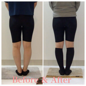 骨盤矯正、ヒップアップ