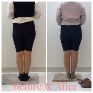 骨盤矯正、産後の骨盤矯正