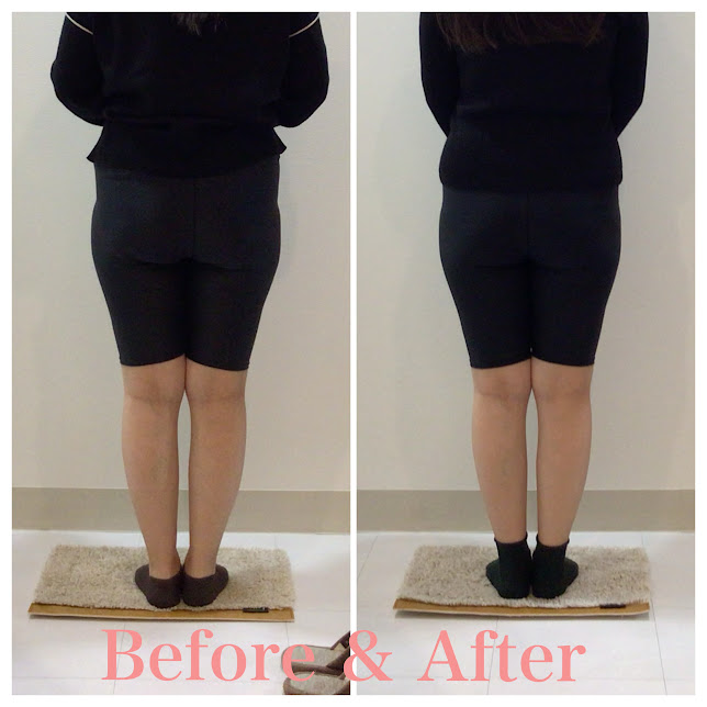 骨盤矯正、産後の骨盤矯正