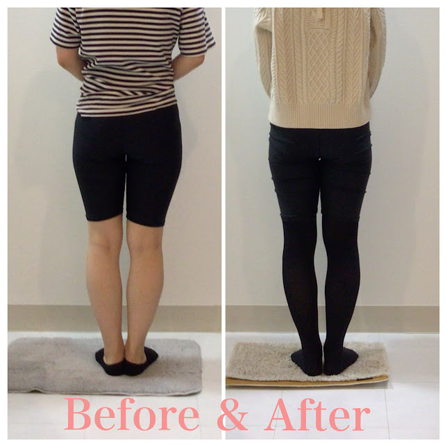 骨盤矯正、産後の骨盤矯正