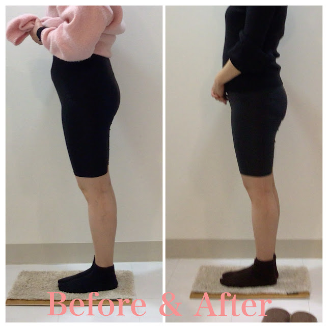 骨盤矯正、産後の骨盤矯正