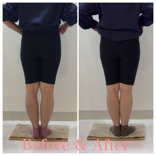 骨盤矯正、産後の骨盤矯正